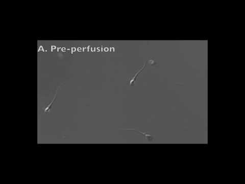 Human spermatozoa before & after entrapment by semen fibrils