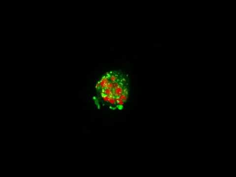 Fibril-associated spermatozoa internalized by macrophage
